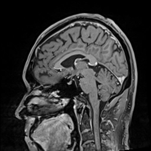 Click on the Serie image to view the images of VILLANUEVA, WILLIAM A.